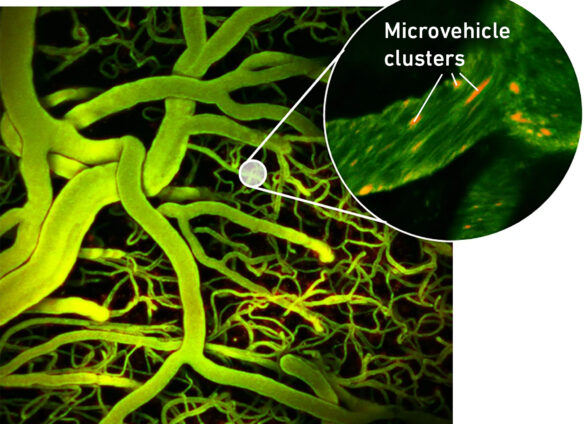 Swiss micro vehicles travel through brain blood vessels